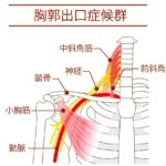 胸郭出口症候群の解剖図(中斜角筋・前斜角筋・鎖骨・小胸筋・神経・動脈)、逗子市の整体・カイロプラクティックで改善