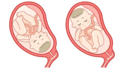 逆子と仙骨の関係｜カイロプラクティックが仙骨を整える理由｜逗子