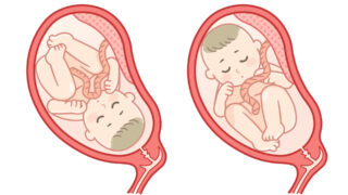 逆子と仙骨の関係｜カイロプラクティックが仙骨を整える理由｜逗子